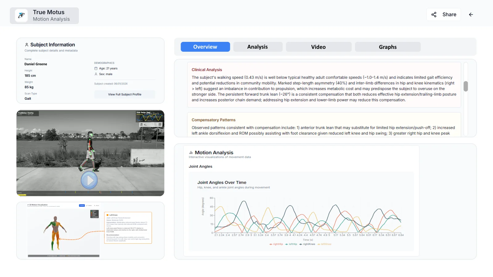 True Motus scan detail — subject info, gait video, 3D pose visualisation, clinical analysis, and joint-angle chart